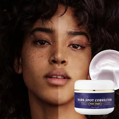 7-Day Dark Spot Corrector & Whitening Face Cream