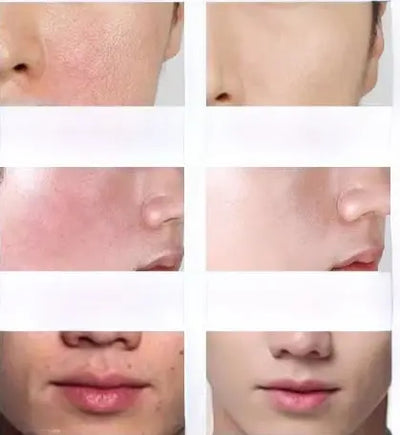 Hydrating Men’s Facial Cream - Winter Moisturizer 270g