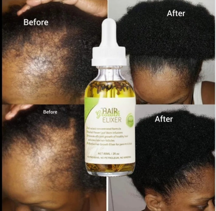 100% Natural Organic Rosemary Castor Almond Oil Scalp Care
