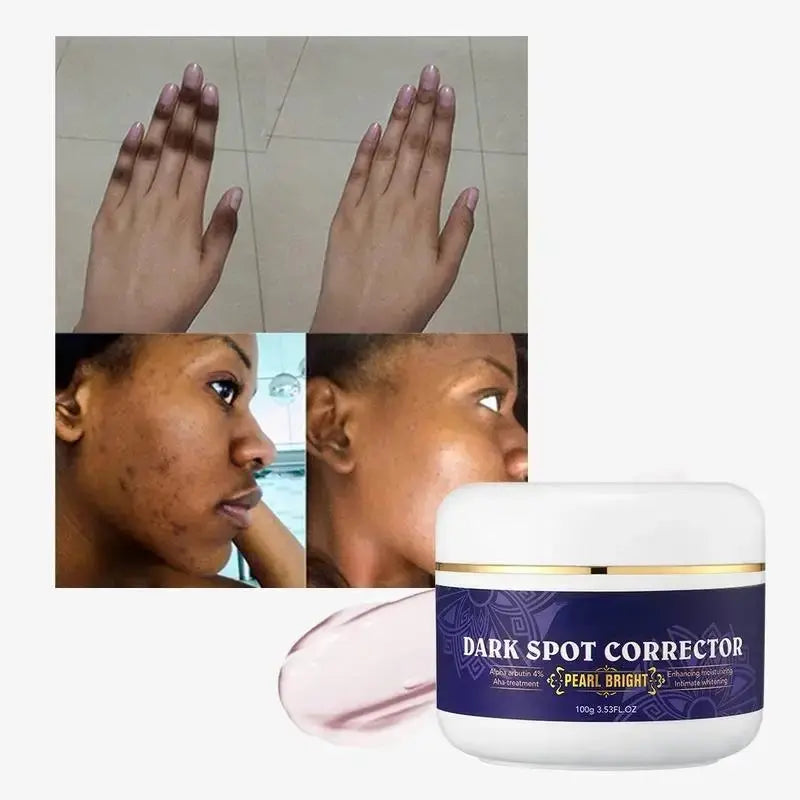 7-Day Dark Spot Corrector & Whitening Face Cream