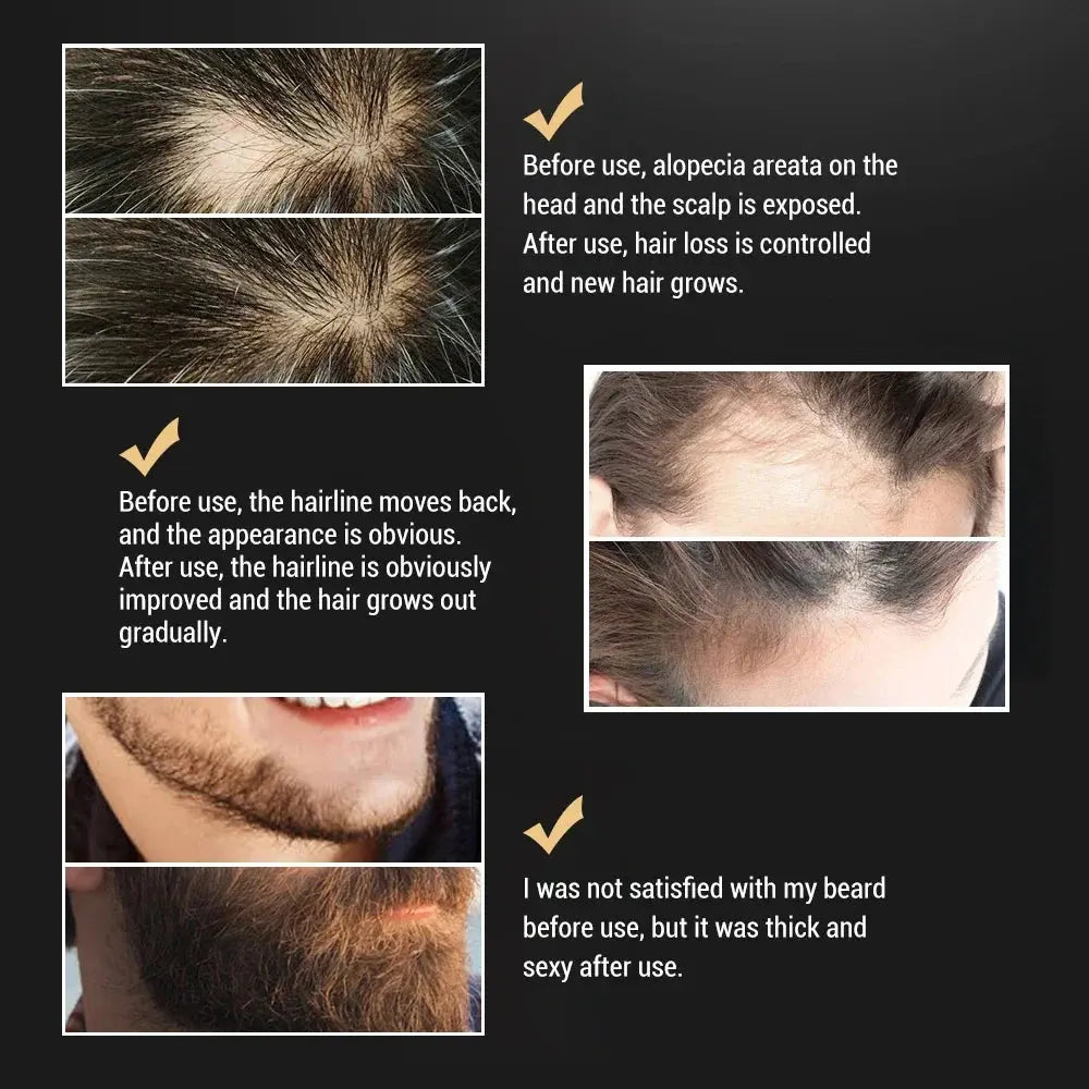 Beard Oil For Men Beard Growth Serum Beards Oil Leave-in Conditioner Restore Natural Moisture And Soften Your Beards To Prevent