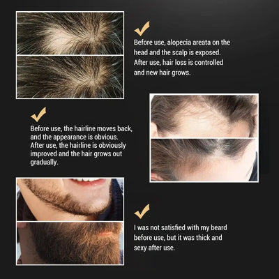 Beard Oil For Men Beard Growth Serum Beards Oil Leave-in Conditioner Restore Natural Moisture And Soften Your Beards To Prevent